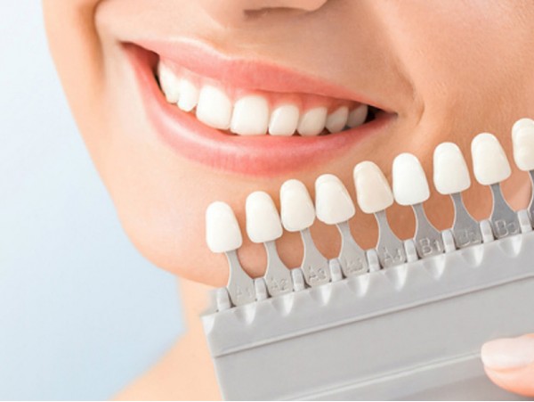 Blanqueamiento dental ¡100% profesional!