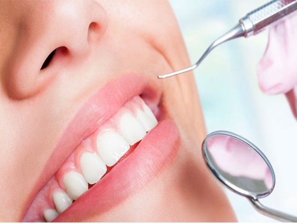 Limpieza bucal con fluoración o blanqueamiento dental