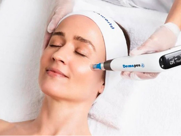 Sesión de dermapen facial en Santa Cruz