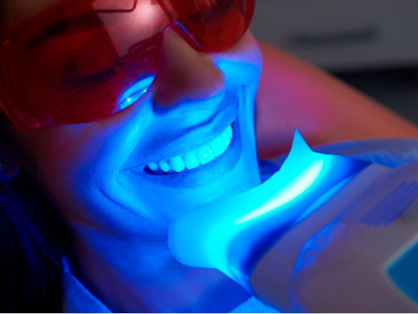 Blanqueamiento dental con técnica innovadora ¡Luce una sonrisa radiante!