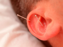 Sesión completamente relajante con acupuntura y auriculoterapia