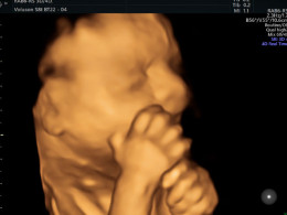 EcoAura - San Isidro 