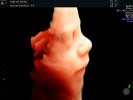 EcoAura - San Isidro 