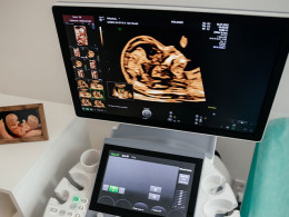 Ecografía con visualización 5D + foto impresa y audio del latido